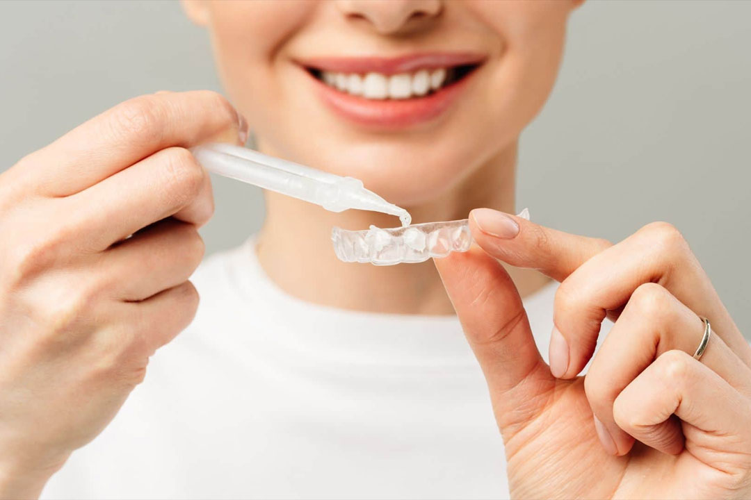 general-dentistry-treatment-